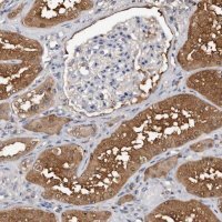 Anti-DNPH1 antibody produced in rabbit HPA029675-100UL