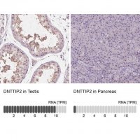 Anti-DNTTIP2 antibody produced in rabbit 
