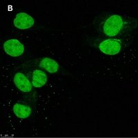 Anti-DOCK11 Antibody, clone 1F11 ZooMAb� Rabbit Monoclonal 
