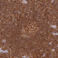 Anti-DOCK2 antibody produced in rabbit HPA036469-100UL