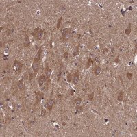Anti-DOHH antibody produced in rabbit 