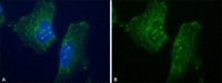 Anti-Dopamine Transporter (N-terminal) antibody produced in rabbit 