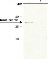 Anti-Doublecortin (N-terminal) antibody produced in rabbit 