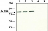 Anti-Doublecortin antibody produced in rabbit