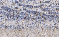 Anti-Doublecortin Antibody, clone 3F11 ZooMAb® Rabbit Monoclonal