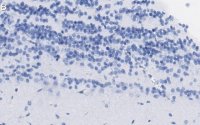 Anti-Doublecortin Antibody, clone 3F11 ZooMAb® Rabbit Monoclonal