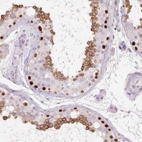 Anti-DPPA4 antibody produced in rabbit 