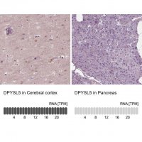 Anti-DPYSL5 antibody produced in rabbit 
