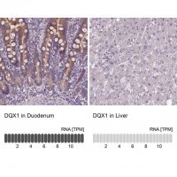 Anti-DQX1 antibody produced in rabbit 