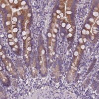 Anti-DQX1 antibody produced in rabbit 