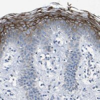 Anti-DSC1 antibody produced in rabbit