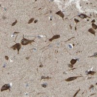 Anti-DSCAM antibody produced in rabbit