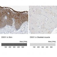 Anti-DSG1 antibody produced in rabbit HPA022128-100UL