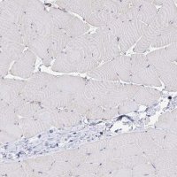 Anti-DSP antibody produced in rabbit 