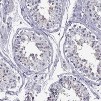 Anti-DUSP15 antibody produced in rabbit