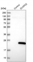 Anti-DUSP22 antibody produced in rabbit 