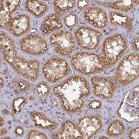 Anti-DYNC1I2 antibody produced in rabbit