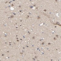 Anti-DYNLT3 antibody produced in rabbit 