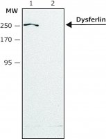 Anti-Dysferlin (N-terminal region) antibody produced in rabbit SAB4200388-200UL