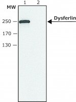 Anti-Dysferlin antibody produced in rabbit SAB4200387-200UL