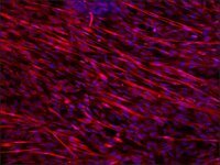 Anti-Dysferlin antibody produced in rabbit SAB4200387-200UL