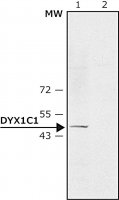 Anti-DYX1C1 (N-terminal) antibody produced in rabbit 