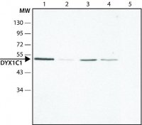 Anti-DYX1C1 (N-terminal) antibody produced in rabbit 