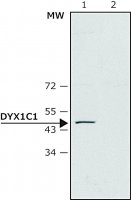 Anti-DYX1C1 antibody produced in rabbit 