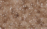 Anti-EAAT2 Antibody, clone 1K8 ZooMAb� Rabbit Monoclonal 