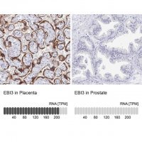 Anti-EBI3 antibody produced in rabbit