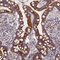 Anti-ECSIT antibody produced in rabbit 