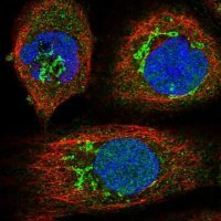 Anti-EDN1 antibody produced in rabbit 