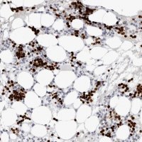 Anti-EDN2 antibody produced in rabbit 