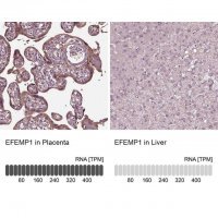 Anti-EFEMP1 antibody produced in rabbit 