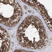 Anti-EHBP1 antibody produced in rabbit 