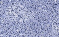 Anti-eIF3h Antibody, clone 2B15 ZooMAb® Rabbit Monoclonal