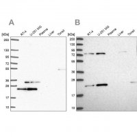 Anti-EIF3K antibody produced in rabbit 