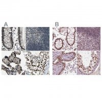 Anti-ELF2 antibody produced in rabbit 