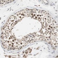 Anti-ELOA antibody produced in rabbit 