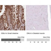 Anti-EML4 antibody produced in rabbit 