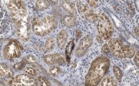 Anti-Endoglin Antibody, clone 1I15 ZooMAb� Rabbit Monoclonal 