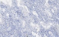 Anti-Endoglin Antibody, clone 1I15 ZooMAb® Rabbit Monoclonal