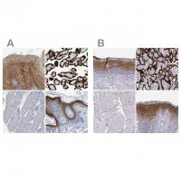 Anti-ENDOU antibody produced in rabbit 