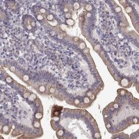 Anti-ENTPD8 antibody produced in rabbit 