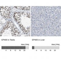 Anti-EP400 antibody produced in rabbit 
