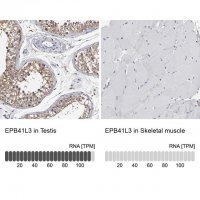Anti-EPB41L3 antibody produced in rabbit 