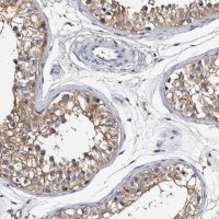 Anti-EPB41L3 antibody produced in rabbit