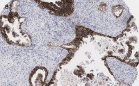 Anti-EpCAM Antibody, clone 1B8 , ZooMAb® Rabbit Monoclonal