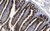 Anti-ErbB-3/HER3 Antibody, clone 1C8 ZooMAb� Rabbit Monoclonal 
