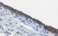 Anti-ErbB2/HER-2 Antibody, clone 1B13 ZooMAb� Rabbit Monoclonal 